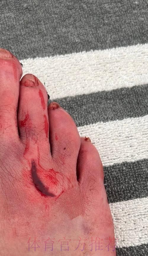 本泽马本场比赛脚踝受伤 应该不影响出战国家德比